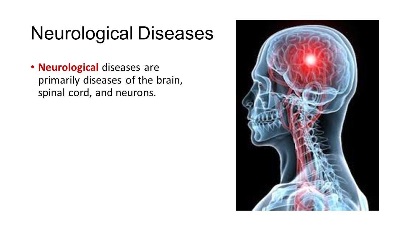 List of neurological conditions and disorders